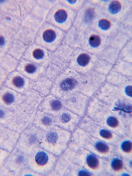 Allium cepa Root Tip Cells Showing Chromosomes During Telophase Stage of Mito