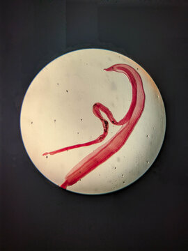 Schistosoma japonicum Paired Male and Female Worms in Copula Microscopy Prepar