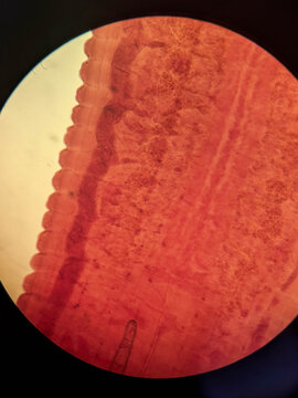 Trematode Adult Fluke Anterior End Showing Oral Sucker and Proglottid-Like Segmentation Under