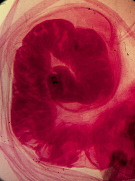 Taenia solium Adult Pork Tapeworm Scolex Showing Rostellum Hooks and Suckers Under Micro