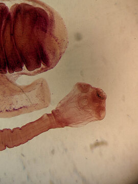 Taenia solium Cysticercus cellulosae Showing Invaginated Scolex and Bladder Wall Under M
