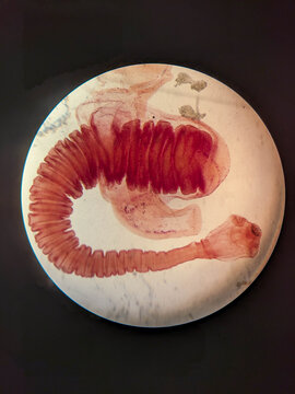 Taenia solium Cysticercus cellulosae Showing Invaginated Scolex and Bladder Wall Under M