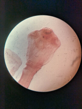 Taenia solium Scolex Showing Armed Rostellum Double Crown Hooks and Four Suckers