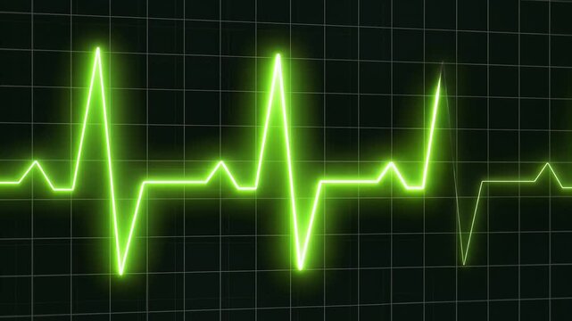 Neon glowing ecg heartbeat wave digital pulse animation for medical technology and science data monitor