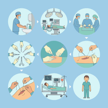 Medical procedure steps shown in a circular diagram