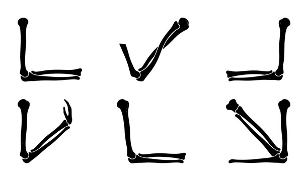 Human elbow joint bones in different positions - medical anatomy illustration Vector