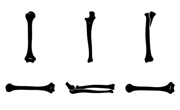 Set of human arm bones, humerus, radius, and ulna, isolated on white background Vector