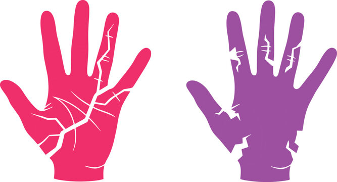 Broken and Cracked Hand Silhouette Set with Red and Purple Colors Featuring Fracture Lines and Splinters for Injury or Pain Vector Design