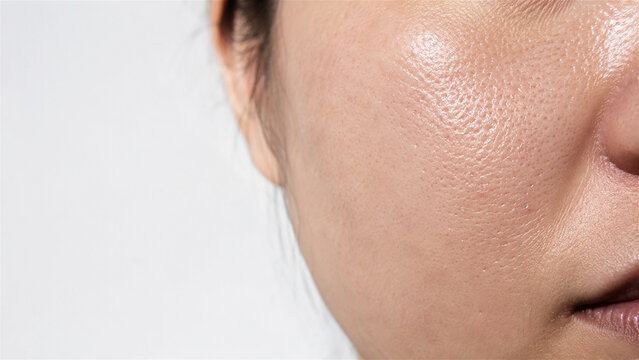 woman with visible skin pores on cheek extreme close up. Dermatology and cosmetology concept. Detailed shot of human face showing skin texture for spa and beauty skincare advertisement