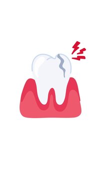 animation cracked tooth anatomy on white background