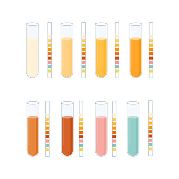 Urinal test kit set of urine sample cup and urinalysis reagent strips for kidney exam, urinary tract infection and cystitis diagnostics. Ketone and PH rapid testing. Medical vector illustration.