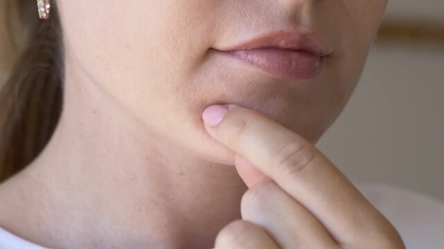 Transparent hydrocolloid patch on female chin during daily skincare routine. Modern invisible acne treatment concept for beauty brands, dermatology clinics and cosmetic advertising.