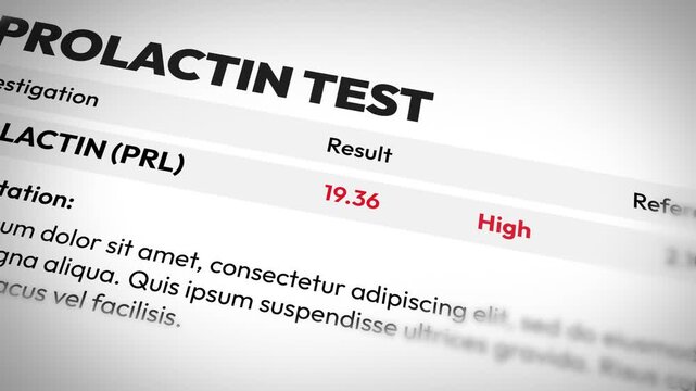 High Prolactin Test Result Analysis in medical report for hormone health evaluation, 4k Animation