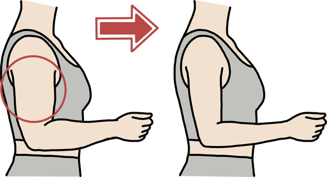 Woman slimming arm flabby fat reduction before and after upper body fitness illustration