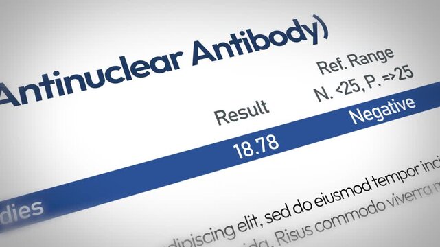 4k antinuclear antibody test report showing negative result with reference range and value 1904 in medical diagnosis and healthcare analysis concept