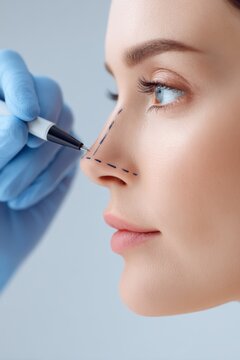 Surgeon drawing correction lines on woman nose before plastic surgery operation