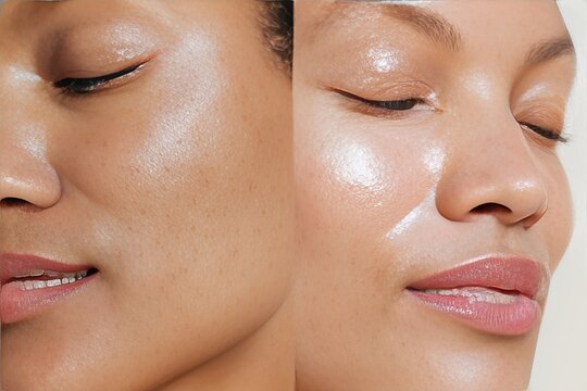 Close-up diptych of two identical women showcasing glowing skin with highlighted cheekbones and smooth complexion, emphasizing beauty and skincare in a neutral background