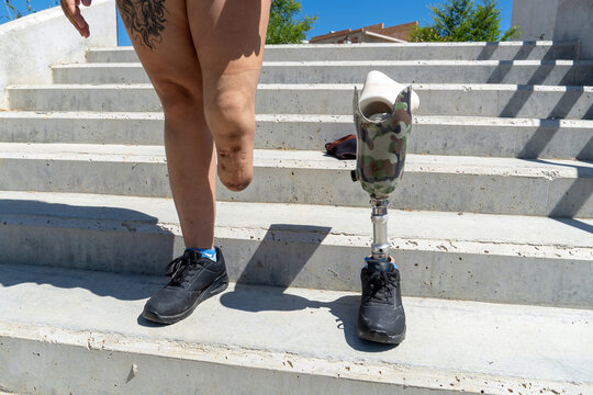 Person with amputated leg and prosthetic limb featuring camouflage design standing on concrete stairs on a sunny day