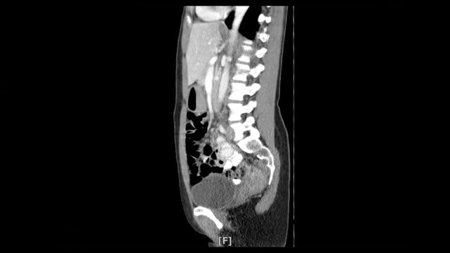 x-ray scan of body by mri ct scan Internal Organs and Liver,Lungs,Intestines,Stomach,Bladder,Kidneys.