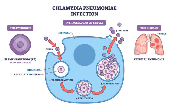 Chlamydia pneumoniae infection life cycle shown through entry, replication, and release inside a host cell, elementary bodies, reticulate bodies, and lungs illustrated, transparent background.