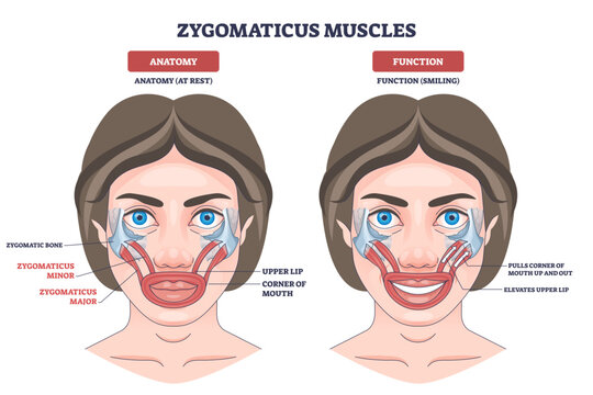 Zygomaticus muscles outline explains smile mechanics, showing major and minor elevating upper lip and mouth corners, focus on zygomaticus major, zygomaticus minor, upper lip, transparent background.
