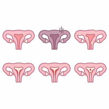 Uterus and Gynecology Health Problems Vector Icon Set