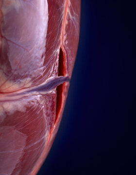 Patent Foramen Ovale Interatrial Septum Medical Macro