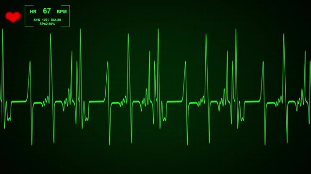 Green electrocardiogram display showing heart rate vital metrics. Medical health monitor dashboard symbol for hospital cardiology care. Animated ecg screen.