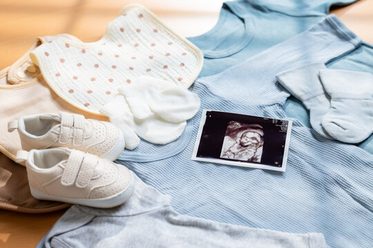 Baby clothes with ultrasound scan photo