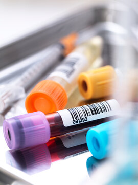 Samples in a tray in a laboratory