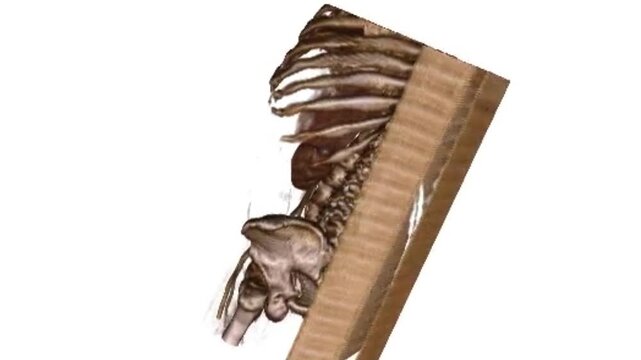 3D CT Scan Rotation Showing Human Torso Rib Cage Spine Pelvis and Abdominal Blood Vessels