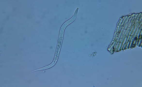 microscope image of microorganisms, nematodes