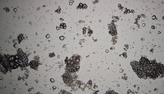 Bright-field microscope image of sourdough starter for bread making