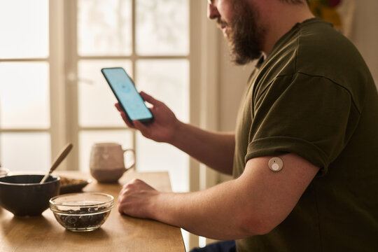 Young man checking glucose app on smartphone while wearing continuous monitor at home, managing diabetes care. Useful for telehealth, chronic disease, wellness marketing