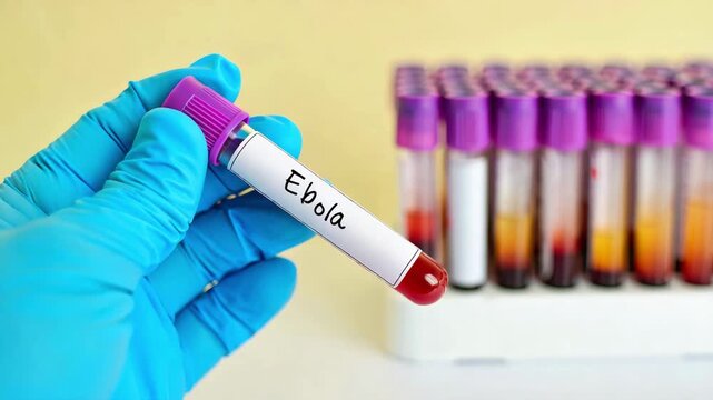Gloved hand holding ebola virus positive sample test tube close up for medical laboratory research on hemorrhagic fever bundibugyo strain outbreak evd epidemic global infection epidemic model