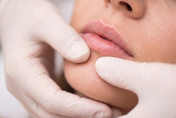 Naklejka premium Close-up of a person's lips and chin being gently examined by gloved hands, cosmetic procedure concept.