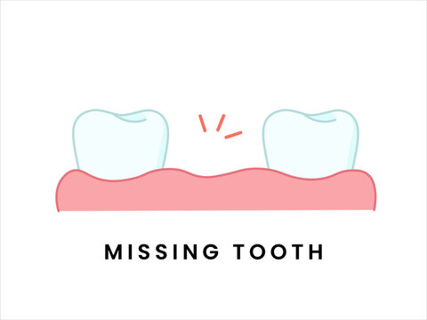 Missing Tooth Dental Problem Illustration. Tooth Loss and Gap Flat Dental Icon.