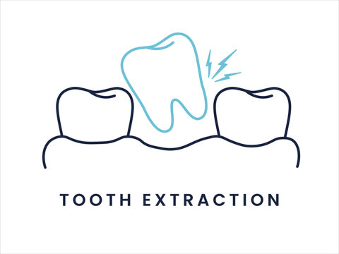 Tooth Removal Dental Procedure Outline Icon. Tooth Extraction Treatment Flat Dental Icon.