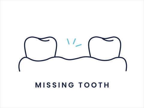 Missing Tooth Dental Problem Outline Icon. Tooth Loss and Gap Flat Dental Icon.