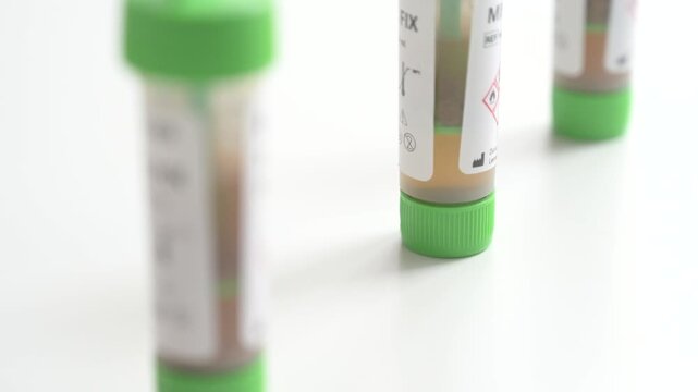 Gloved hand handling stool sample containers for medical analysis, isolated on white background