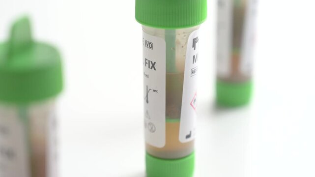 Laboratory assistant places stool sample tubes for analysis on a white background in a medical lab