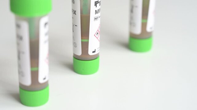 Several medical stool sample collection tubes waiting for analysis in a laboratory on a white background