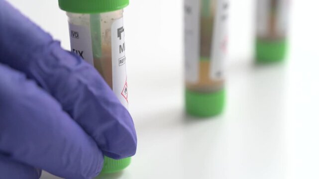 Medical professional in blue gloves picking up a stool sample tube on a white background