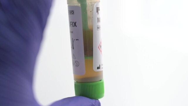 Medical technician preparing a fecal occult blood test for analysis, isolated on white background