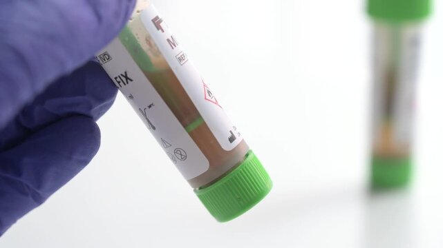 Laboratory technician holding a fecal sample in a test tube isolated on a white background