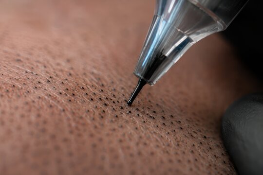 Scalp micropigmentation needle creating pigment dots on scalp extreme macro close up