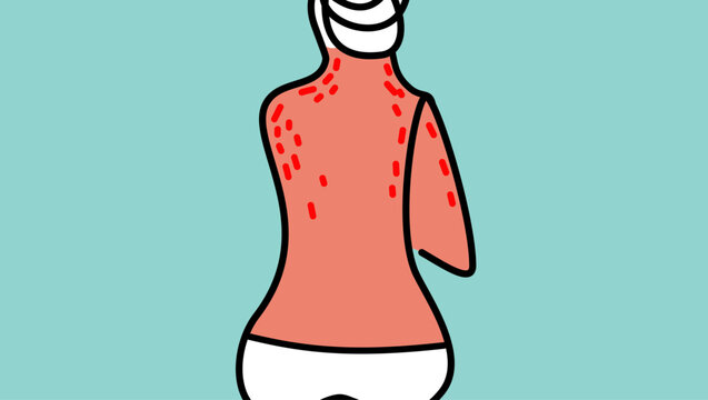 Rash on the back of a young woman, color vector illustration.