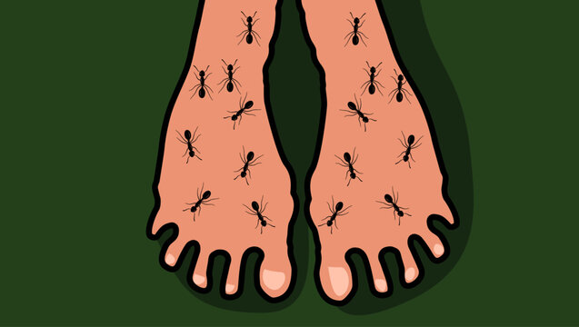Itchy skin on legs, color vector illustration