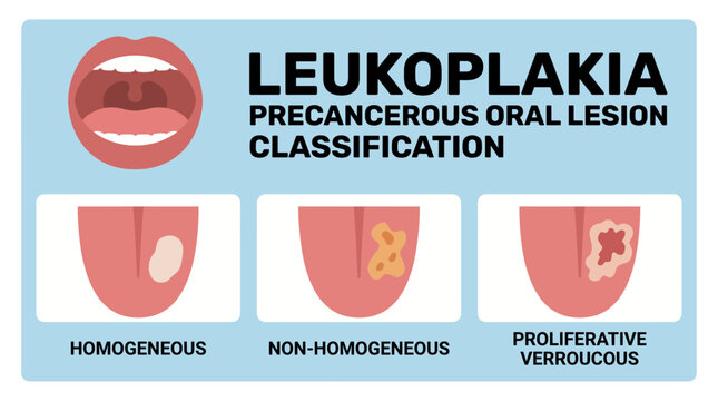 Leukoplakia Precancerous Oral Lesion Classification