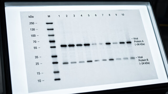 Ebola virus. Close-up of a western blot nitrocellulose membrane on a light box showing dark bands at specific molecular weight positions corresponding to viral protein detection
